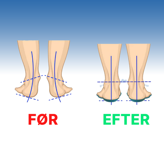 Boldaek Indlægssåler - En hel dag uden smerter